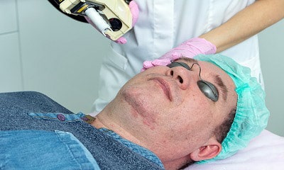 Лечение акне и постакне в центре косметологии Альфа Клиник