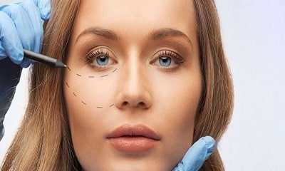 Коррекция носослезной борозды в центре косметологии Альфа Клиник