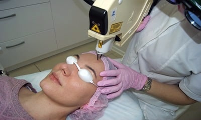 Лазерное удаление сосудов в центре косметологии Альфа Клиник