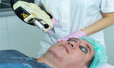 Лечение розацеа в центре косметологии Альфа Клиник